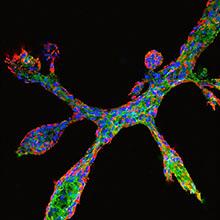 Breast Epithelial Cells