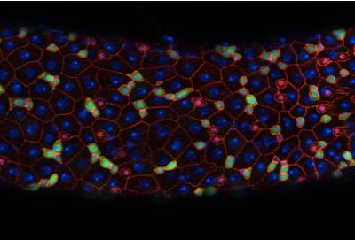 Fruit Fly Intestinal Tissue (1 of 2)