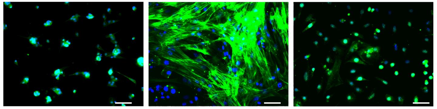Fighting Liver Fibrosis, the Wound that Never Heals