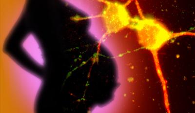 UCP2 Protein Expressed in Natural Birth