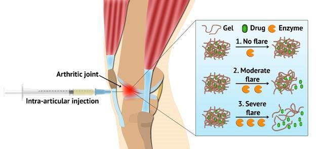 Flare-Responsive Hydrogel Developed to Treat Arthritis