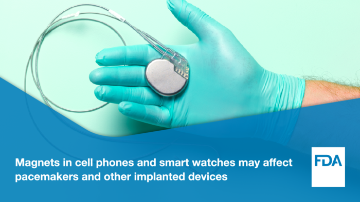 Magnets in cell phones and smart watches may affect pacemakers and other implantable devices