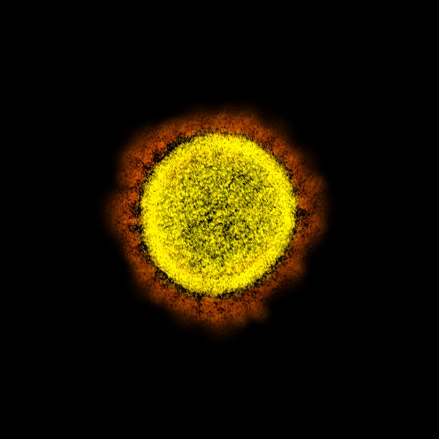 SARS-CoV-2 virus particle