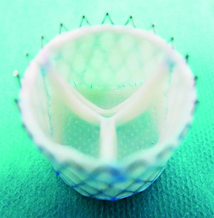 Regenerative Heart Valve