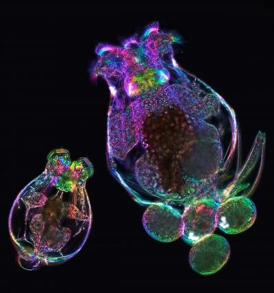 Mother Rotifer (Brachionus manjavacas) Carrying Four Eggs