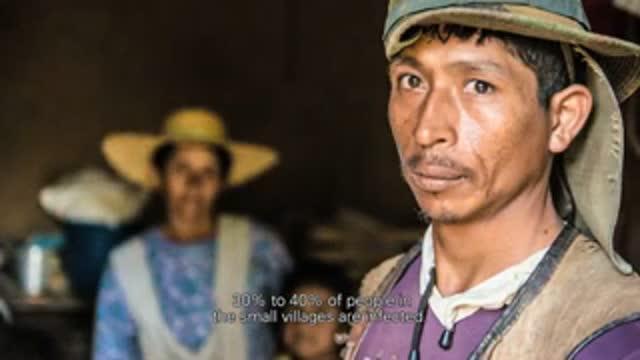 Chagas Disease: A Silent Emergency