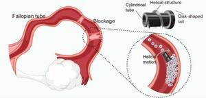 Magnetic robotic microscrew for oviduct recanalization