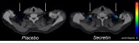 Positron emission tomography images showing glucose tracer uptake
