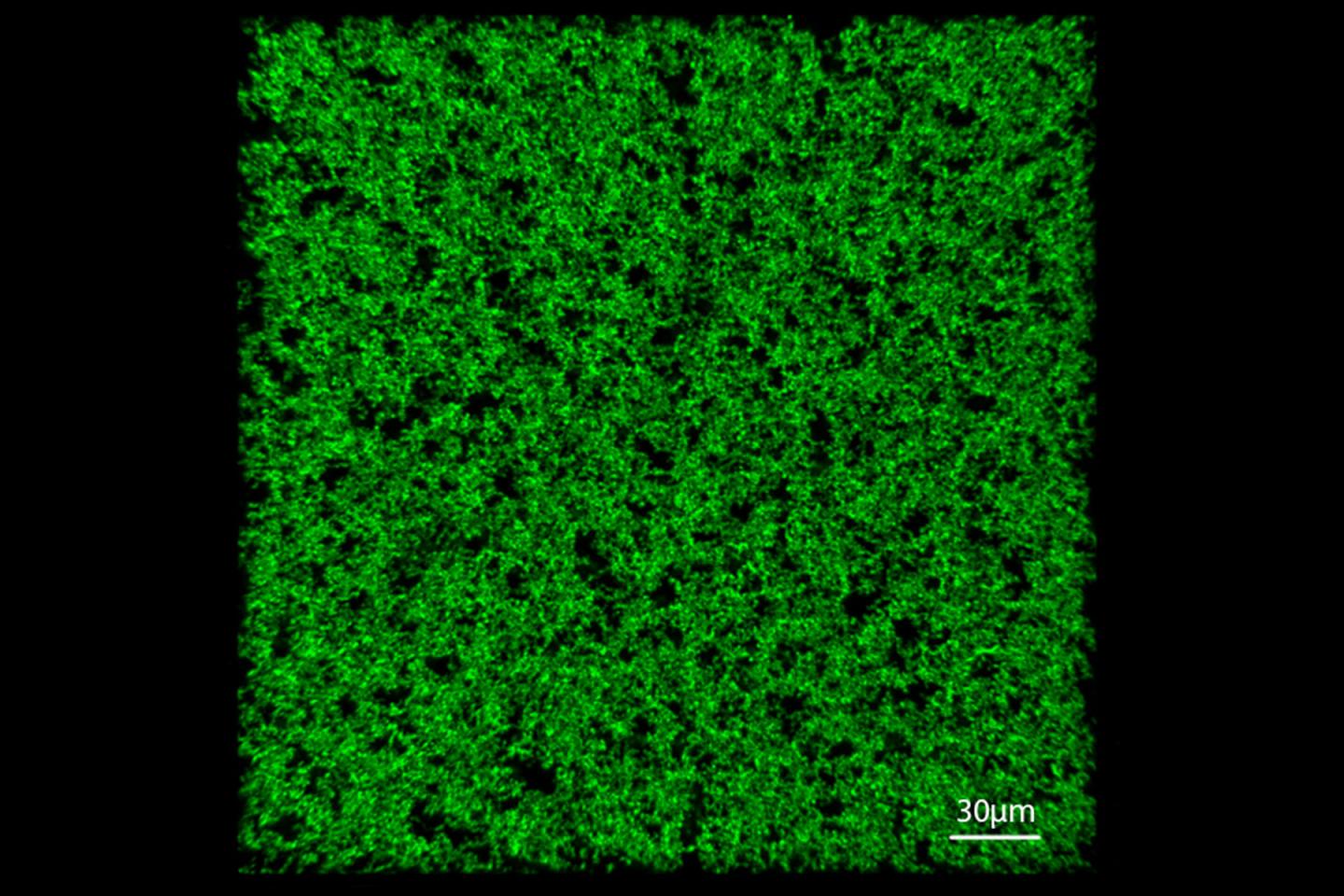 Porous Elastin-Based Network