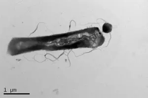 Electron microscopy showing the parasitic Ca. Nha. antarcticus: the small circular shape, attached to its host, Hrr. lacusprofundi. Image Credit: Joshua N Hamm