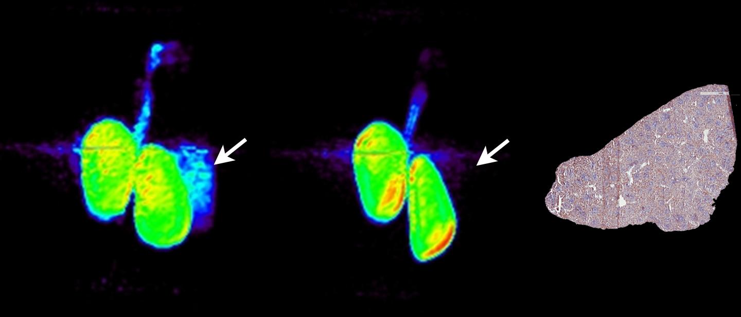 Representative Whole-Body PET Images of Kidneys and Spleen