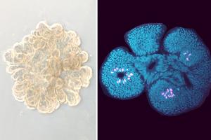 Intestinal organoids