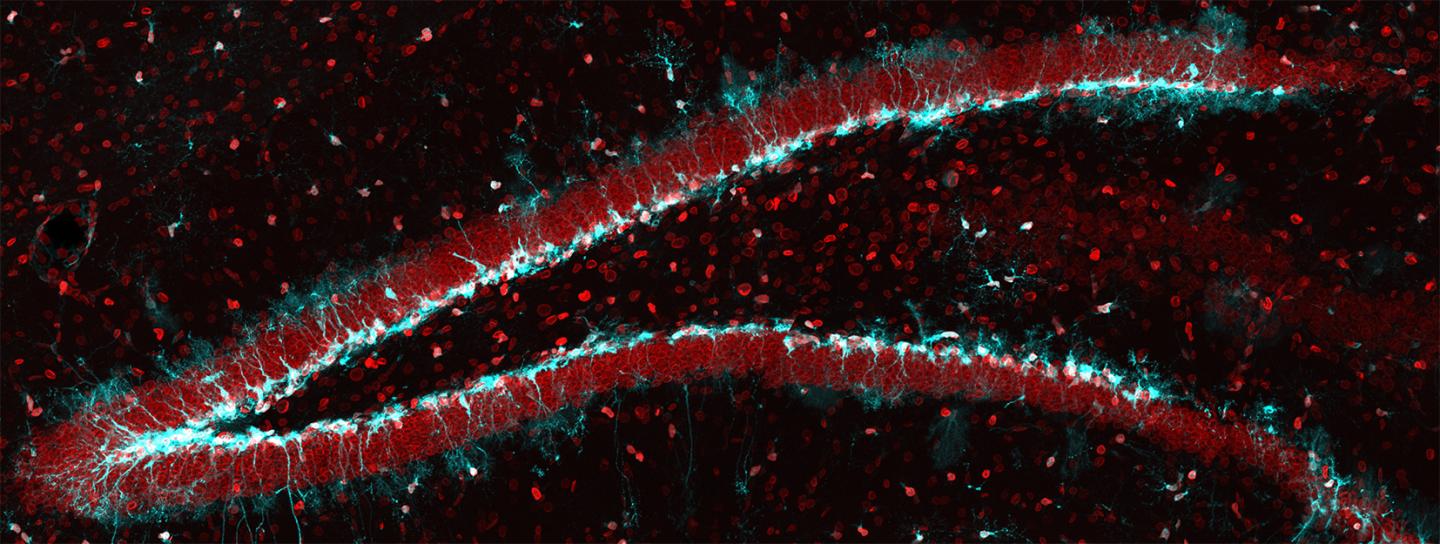 Neural stem cells