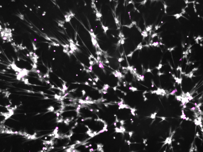 Neutrophil extracellular traps (NETs)