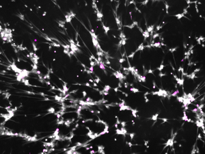 Neutrophil extracellular traps (NETs)