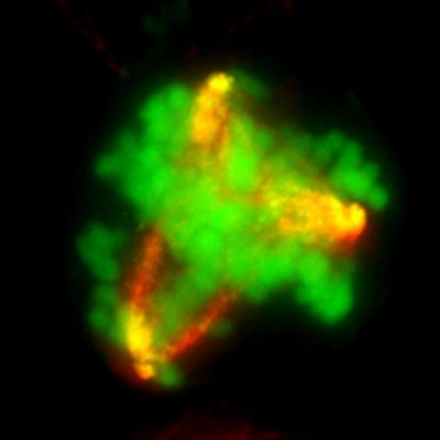 Triple negative breast cancer cell abnormal division