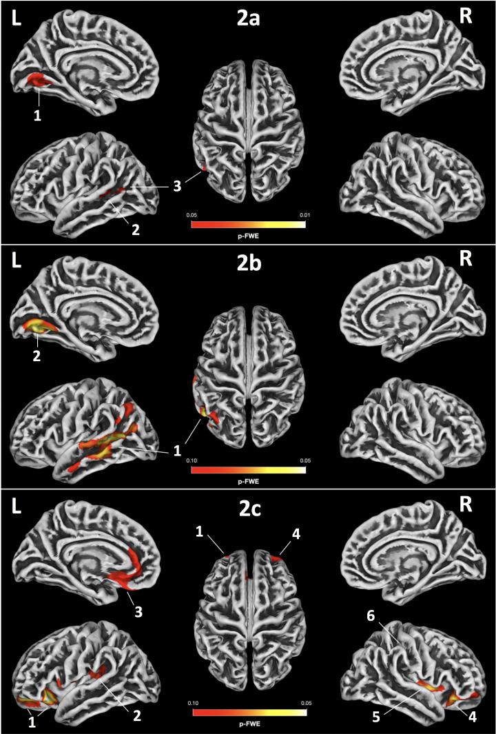 MRI results also the first to indicate relationships between screened skills and early brain development