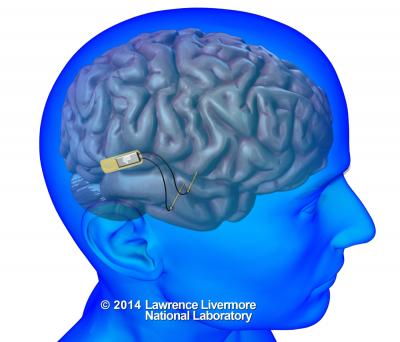 DARPA Selects Lawrence Livermore to Develop World's First Neural Device to Restore Memory