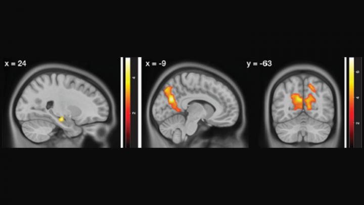 Noisy Brain Activity Contributes to Aging-Related Navigation Impairments