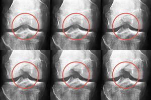 set of screenshots of synthetic x-ray modifying