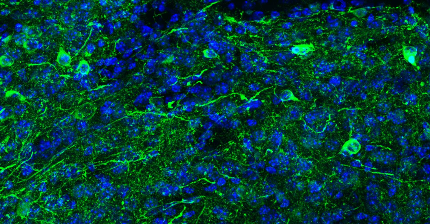 Induced Dopaminergic Neurons