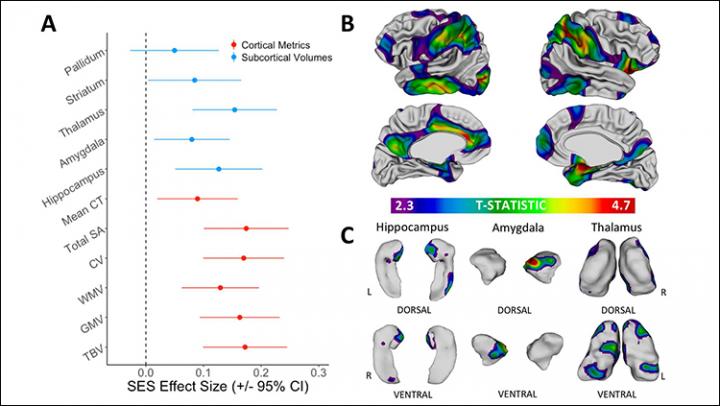 SES & Brain Anatomy