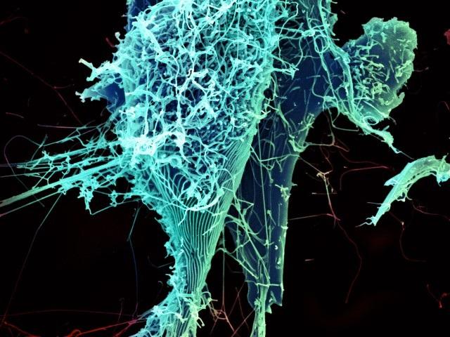 Potential Evidence of Lung-Specific Ebola Infection Found in Recovering Patient