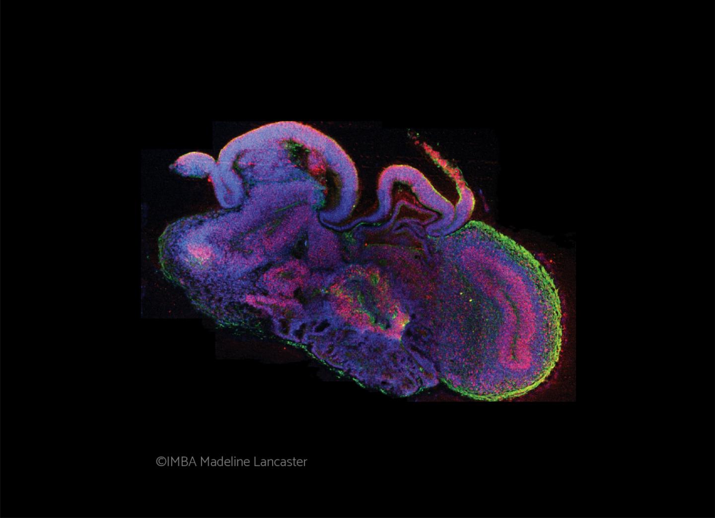 Cerebral organoid cross section