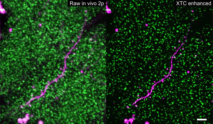SEP-GluA2 tagged synapses