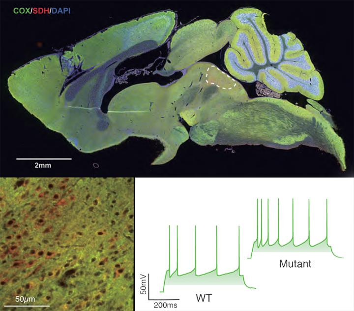Reduced COX Expression Associated With Hyperexcitability Of Serotonergic Neurons