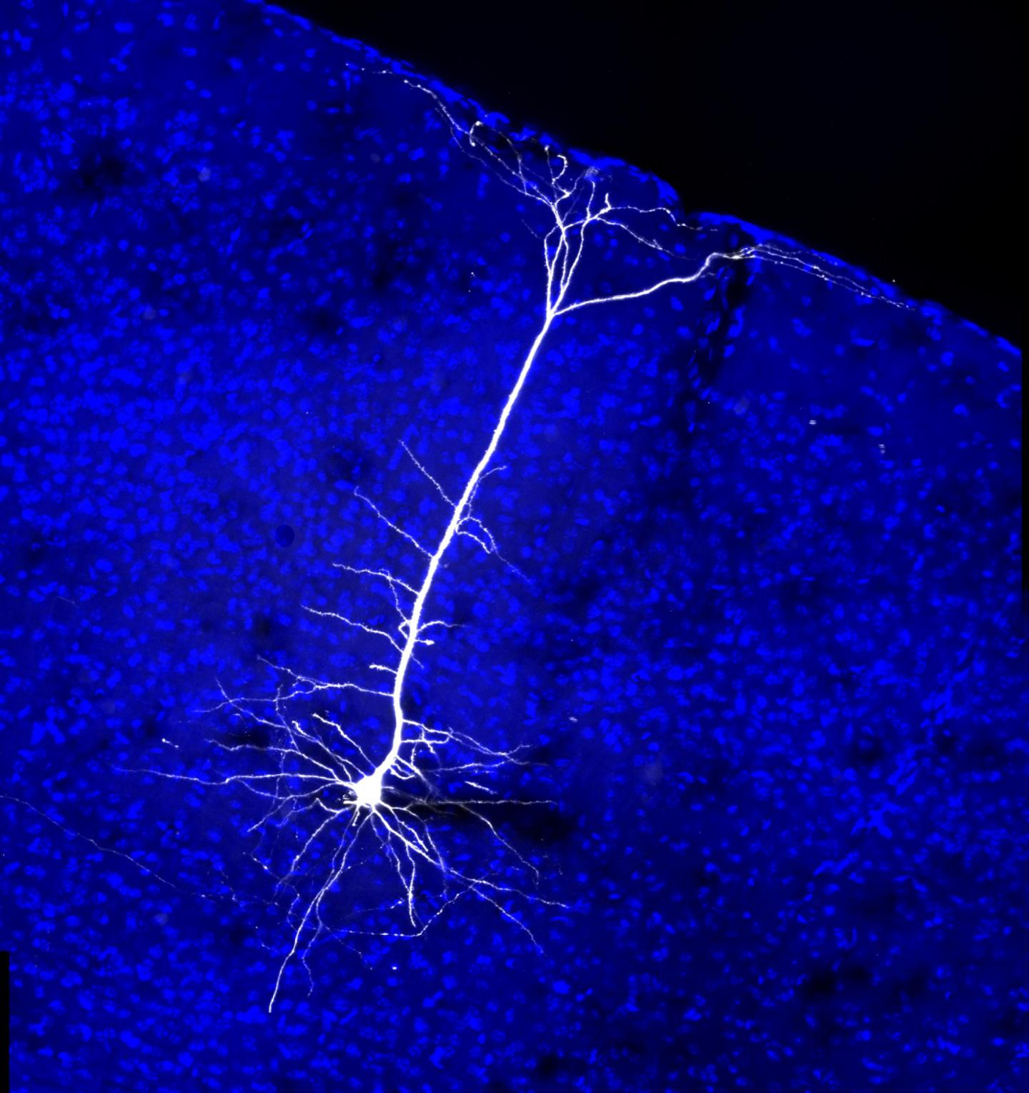 Neuron Projection from the Visual Cortex