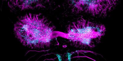 Left/ Right Structural Asymmetry in Zebrafish Neurons