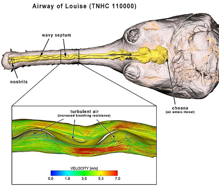 nasal choanae