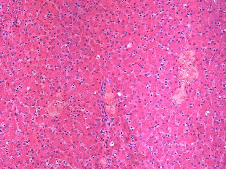 Seal Liver Infected with Hepatitis A-Like Virus (2 of 2)