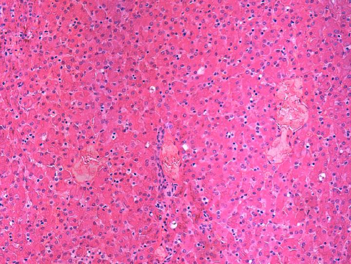 Seal Liver Infected with Hepatitis A-Like Virus (2 of 2)