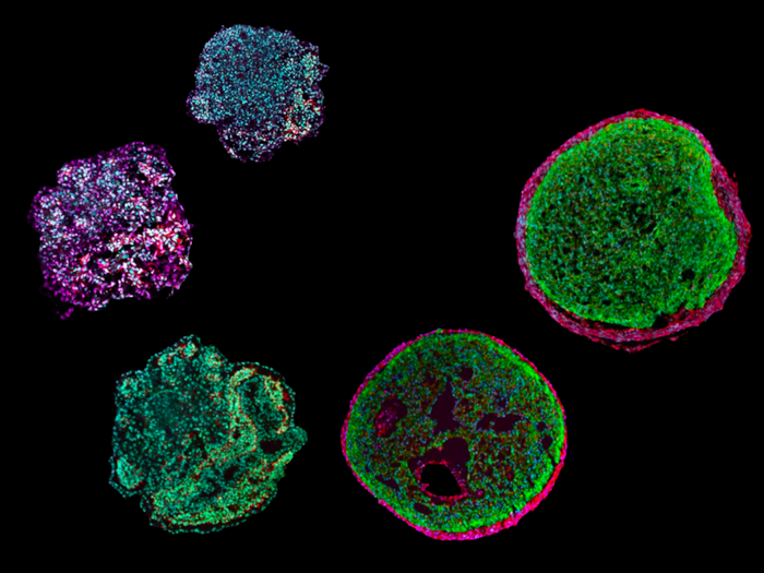 Various stages in the development of heart organoids (Epicardioids).