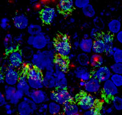 Ebola Receptor TIM-1