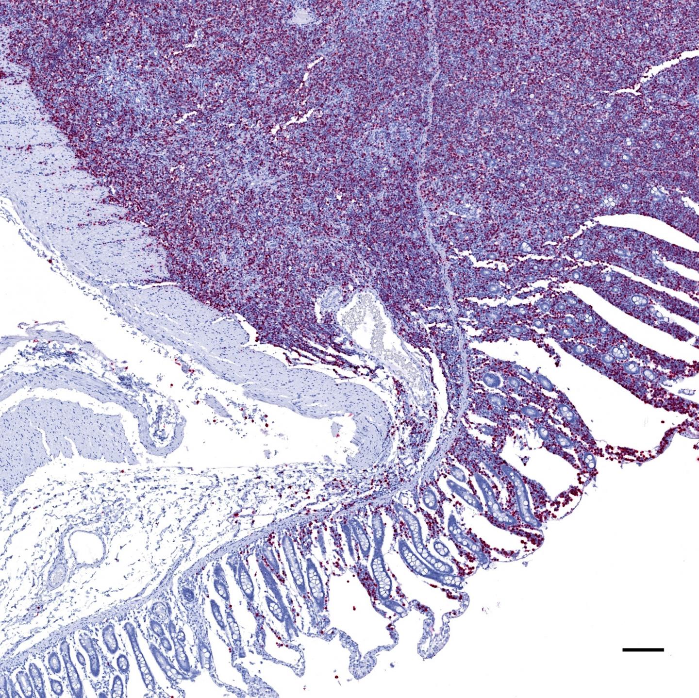 Gammaherpesviruses Linked to T [IMAGE] | EurekAlert! Science News Releases