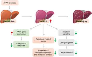 Role of miRNA21 in APAP-induced liver injury