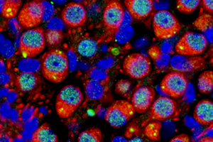 MEF2C expression in nuclei of neuronal cells in inner ear of young adult mouse