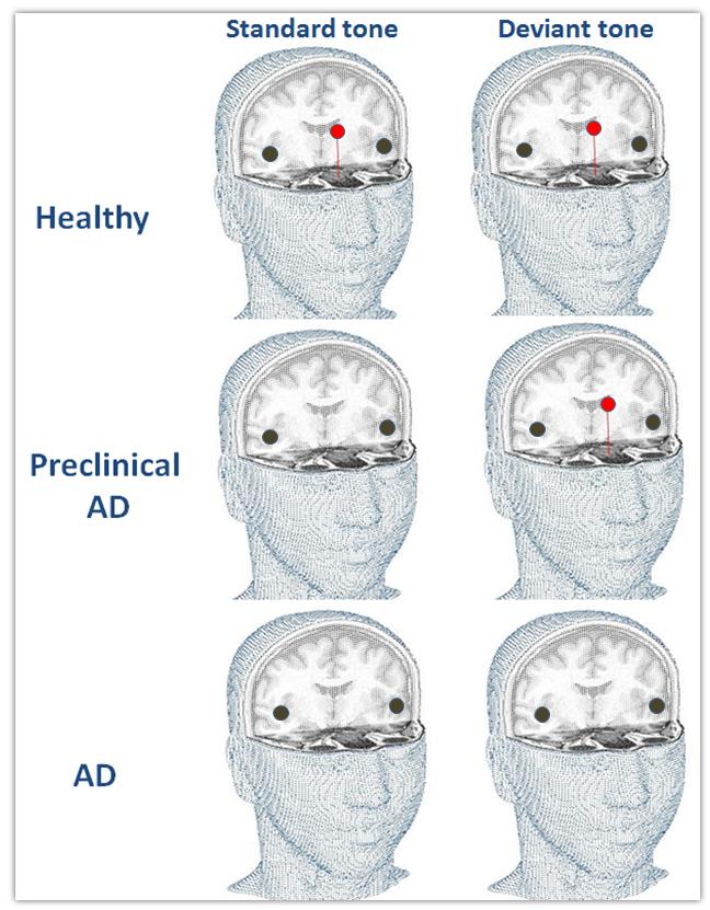 Detection of AD Pathology