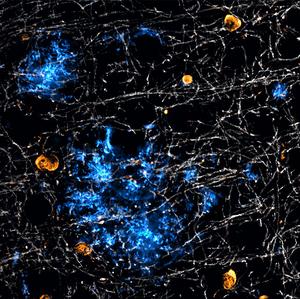 Amyloid beta and oligodendrocytes