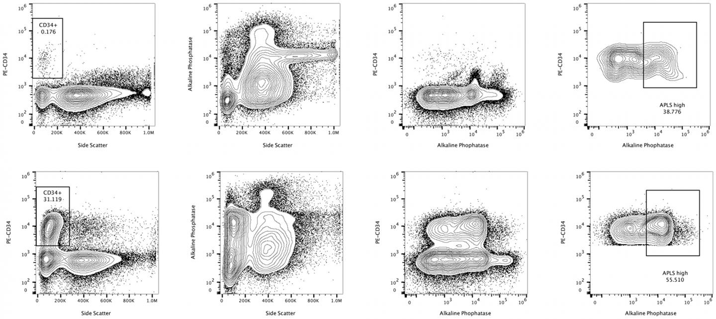 Representative Flow Cytometric Study of the Alkaline Phosphatase Activity in a Patient