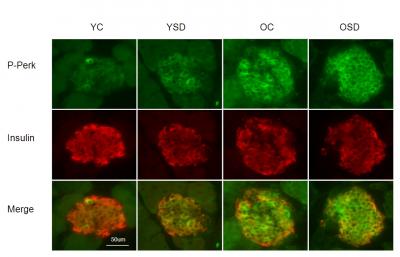 Lack of Shut-Eye, Diabetes, Age