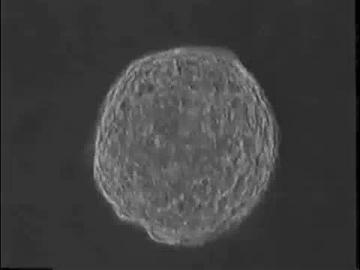 Beating Cluster of Heart Cells