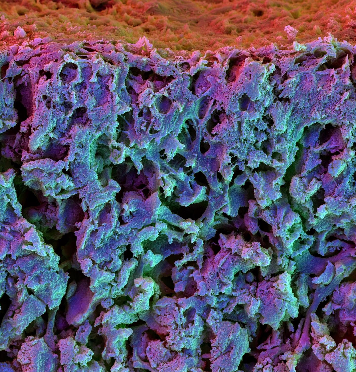 Cross Section of a Fast Relaxing Hydrogel (1 of 2)