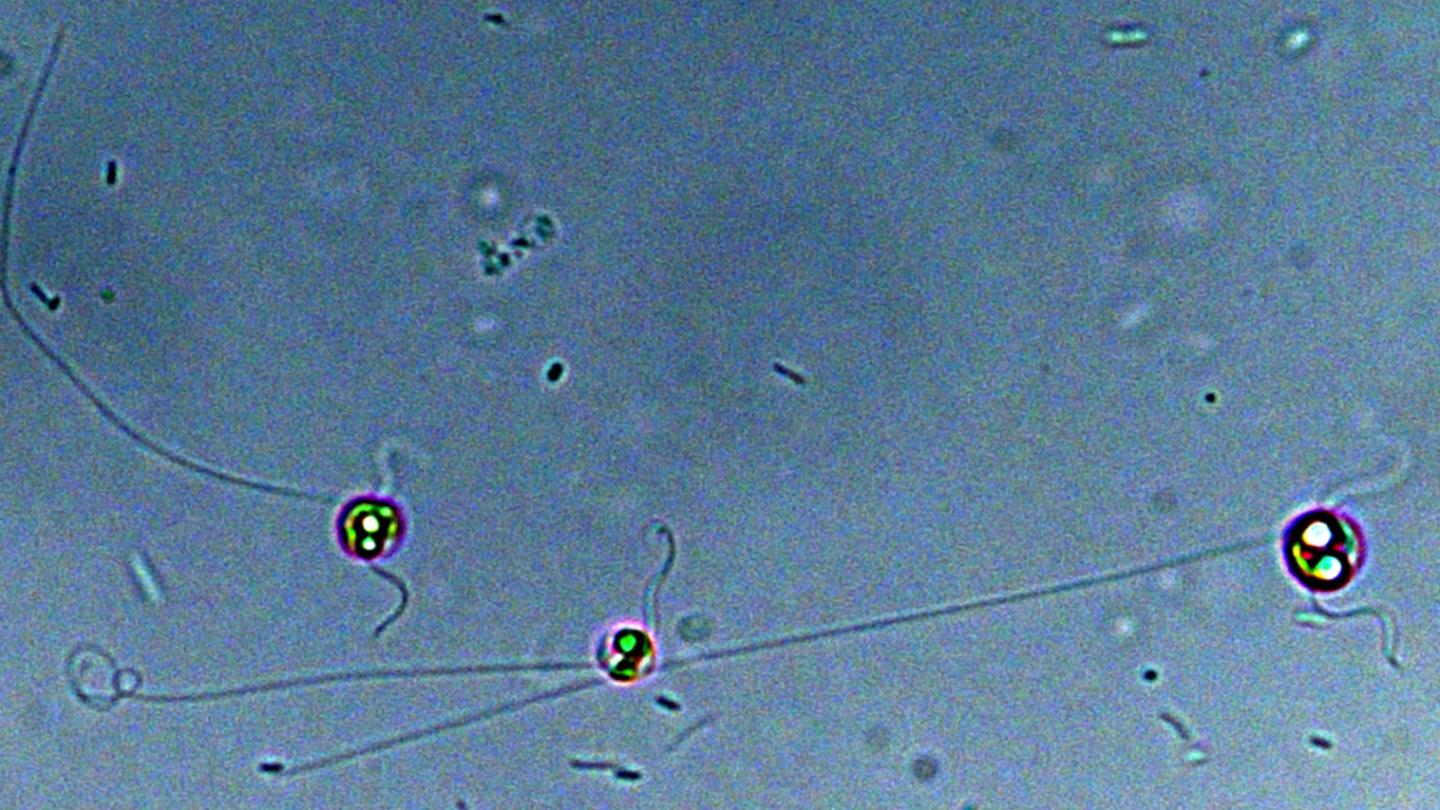 <I>Chrysochromulina</I> (2 of 2)