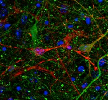 Tau Movement Via Extracellular Space