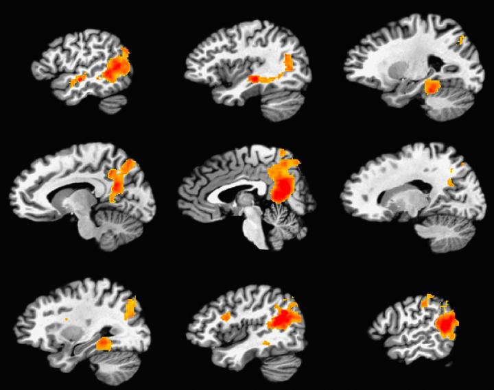 Durable Memory Areas Of Brain