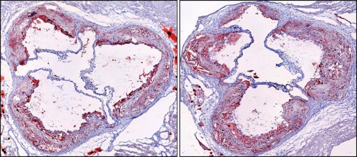 Mouse Arteries before and after Sleep Fragmentation